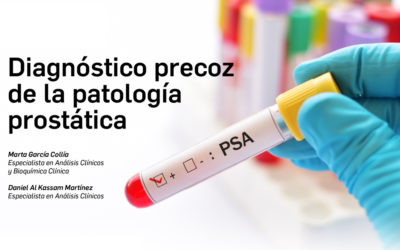 PSA, el primer paso para enfrentarse con éxito al cáncer de próstata